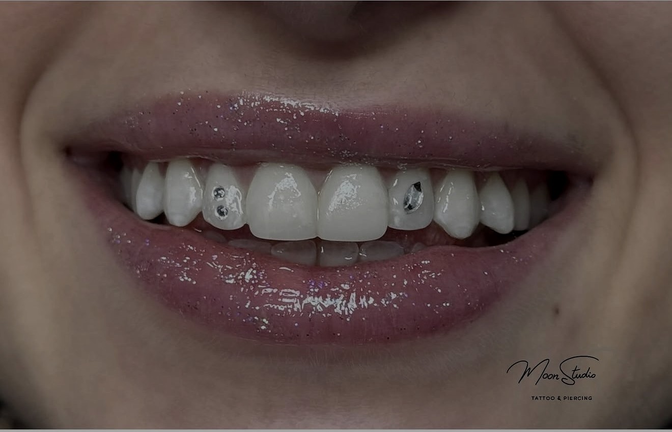 Gema dental Swarovski colocada en Moon Studio